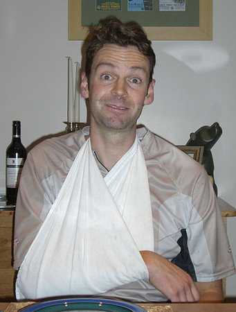 rich broken arm 0ct 05