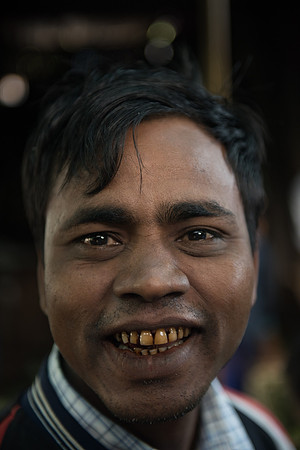 Betel nut teeth